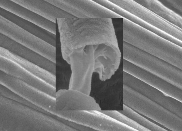 Layer of Strength, Layer of Functionality for Biomedical Fibers