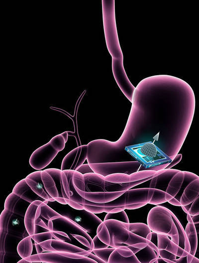 Medicine of the Future: New Microchip Technology Could Be Used to Track Smart Pills