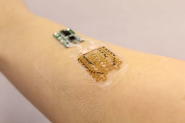 Smart bandages designed to monitor and tailor treatment for chronic wounds