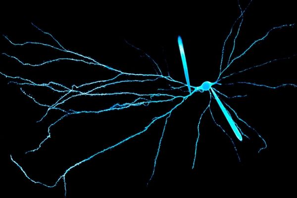 Electrical properties of dendrites help explain our brain's unique computing power