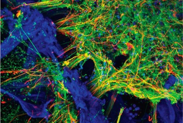Tufts scientists grow functioning human neural networks in 3D from stem cells