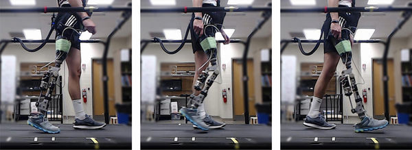 Reinforcement learning steps robotic prosthetics forward