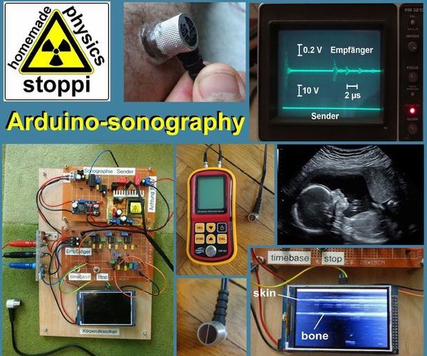 Body-ultrasound Sonography With Arduino