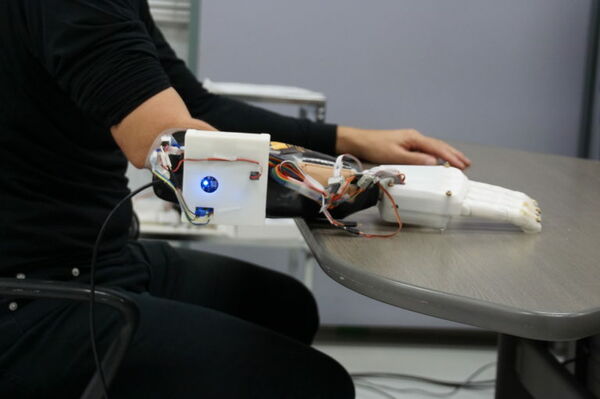 3D printed prosthetic hand can guess how you play Rock, Paper, Scissors