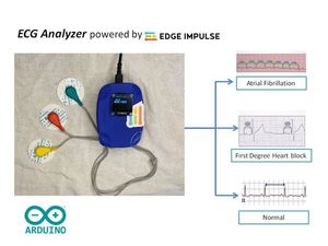 ECG Analyzer Powered by Edge Impulse