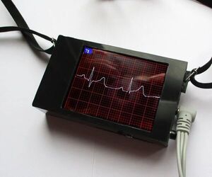 ECG Display With Arduino