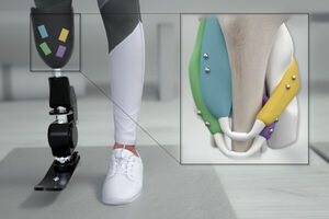 Magnets could offer better control of prosthetic limbs