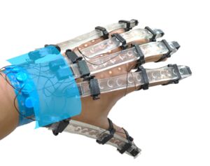 3D printed gloves for rehabilitating stroke patients