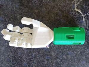 Myoelectric sensor-controlled hand prosthesis