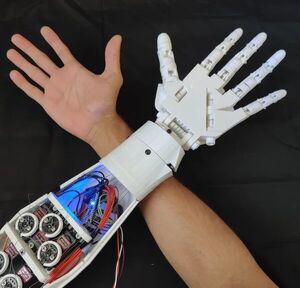 3D Printed EMG Prosthetic Hand